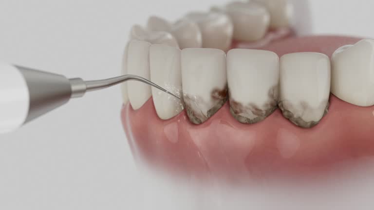 Reliable Dental Crowns And Bridges contractor in Vermilion Parish County, LA by Dentist Open Now